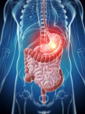 maagontsteking-_gastritis_-en-maagzweer_maag